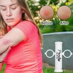 Bug Bite Suction Tool, Venom Extractor Itch Relief, Natural Reduce Itch & Swell