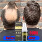 Minoxidil 5% Extras Strength Regrowth Treatment Serum Hair Growth Spray 1 Month