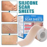 Collagen Scar Tape Scar Sheets Tape Roll Silicone Scar Tape For Delicate Skin UK