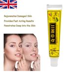 Effective skin blemished cream for Psoriasis, Eczema, Itching skin all - 15g UK