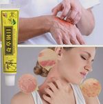 1/3/6/8Pcs Skin Care Cream Natural Organic Herbal Skin Cream Healing Cream-