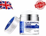 Scar Removal Cream 50ml 2% Dimethicone for Acne Scar Stretch Marks & skin repair