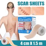 Medical Grade Silicone Scar Tape 4cm x 150cm Reusable Waterproof Scar Sheet Acne