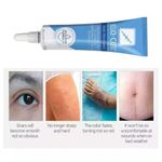 15g Silikongel zur Behandlung von alten und neuen Narben，Scar Treatment UK NEW