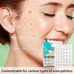 Acne Patches Hydrocolloid, 180 Pieces Spot Patches,Dots for Spots Pimple Patches