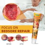 New Natural Bedsore Ointment Effective Bedsore Treatment 20g Cream Protect Skin