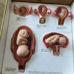 SPUC Educational Trust “How You Began” Womb Model Nursing Hypnobirthing Teaching