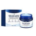 7-Day Skin Tag Spot Eraser Cream, Advanced Imperfection Removal Cream 50g NEW