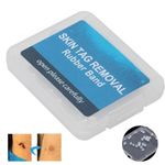 Extra Small Skin Tag Removal Bands 30pcs Micro Skin Tag Removal Rubber Bands UK