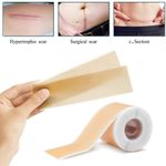 Medical Grade Silicone Scar Strips Silicone Scar Sheets Silicone Scar Tape Roll