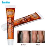 New Natural Vasculitis Blood Circulation Varicose Veins Treatment New Cream 20g