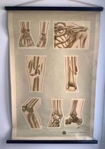 ST. JOHNS ambulance 1930’s poster Fractures