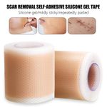 Scar Removal Silicone Gel Tape Efficient Surgery Removal Bandage Tape 4*50/150cm