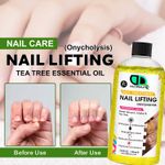 Onycholysis Nail Care | Treatments for Lifting & Weak Nails, Restore Nail Health