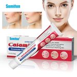 New Rosacea Ointment Treat Red Nose Acne 20g Cream Pimple Scar Repair Skin Care