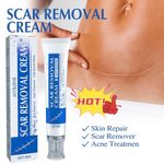 SCAR REMOVAL CREAM Skin Repair Scar Remover丨Fade Stretch Mark丨Acne Treatment 1 x