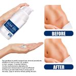 Advanced Silicone Scar Gel Stretch Marks Removal Cream Surgery Scar Skin Care