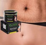 Best Scar Removal-Cream for Old-Scars Stretch Mark Removal Cream UNISEX 100g