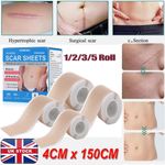 4CMX150CM Scar Sheets Gel Tape Roll Scars Removal Skin Treatment Patch Tapes UK