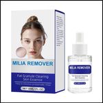 Milia Remover Treatment Spot Removal Serum Fat Granule Clearing Skin SDH