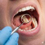 Dentist Dental Mirror with handle Excellent quality Dental Surgical Mouth mirror