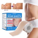 Medical Grade Silicone Scar Tape Roll Sheets Scar Removal Face Treatment Patch