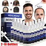 Minoxidil 5% Topical Solution for Men Hair Regrowth, Reactivates Hair Follicles
