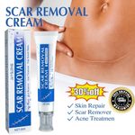 30g SCAR REMOVAL CREAM Skin Repair Scar Remover Acne Treatment Fade Stretch Mark