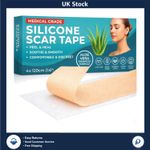 Medical Grade Silicone Scar Tape Aloe Vera 4cm x 1.2M Soft & Discreet