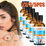 Wart Remover Fast Acting and Painless,Wart Remover Liquid for Face, Hands & Body