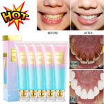 5/3X Niacinamide Whitening Toothpaste Niacinamide Intensive Whitening Toothpaste