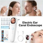 ScopeAround Digital Otoscope with IPS Screen, 720p Visual Camera Smart Ear M9F7