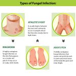 Tetmosol Anti-fungal Dusting Powder fights skin infections prickly heat, itching