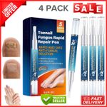 Nail Care Pen, 4Pcs Fungal Nail Pen, Nail Fungus Treatment for Toenail for Toena