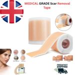 MEDICAL GRADE Scar Removal Tape Silicone Scar Sheet Treatment Patch UK