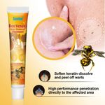 New Bee Venom Warts Remover 20g Ointment Skin Tag Treatment Remove Wart Cream