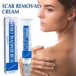 1~3X 30g SCAR REMOVAL CREAM Trauma Skin Repair Scar Remover,Fade Mark Stretch xb