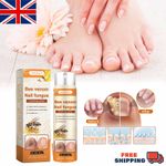 Timilk Fungibee Advanced Nail Repair Spray,Bee Venom Nail Treatments Spray 20ml