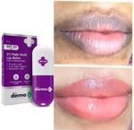 🔥 The Derma Co 1% Kojic Acid Lip Balm 4g Brighten Dark Lips • Smooth • Hydrate 