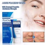 Acne Foaming Wash Face & Body 10% Active ingredient 156g New UK Moisture Sealed