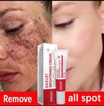 Melasma Treatment Dark Spots Cream Niacinamide Face Skin Brightening UK Seller