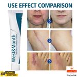 Scars Remover Cream Clear Spots Burns Repairing 20g