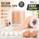 MEDICAL GRADE Scar Removal Tape Silicone Scar Sheet Treatment Patch UK