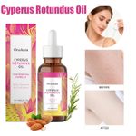 Cyperus Rotundus Oil 60ml For Hair Removal Reducing Body Hair Growth