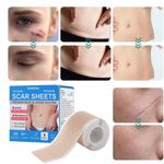 Collagen Scar Tape Scar Sheets Tape Roll For Delicate Skin Silicone Scar Tape