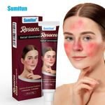 New Natural Herbal Red Face Skin Care Rosacca 30g Cream Red Skin Relief Ointment