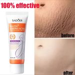stretch- marks removal cream Skin Repair Pregnancy Belly Spots Removal Cream