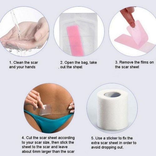 Silicone Gel Sheet Scar Treatment Repair Keloid Cesarean Away Wound Removal ZS — image 10