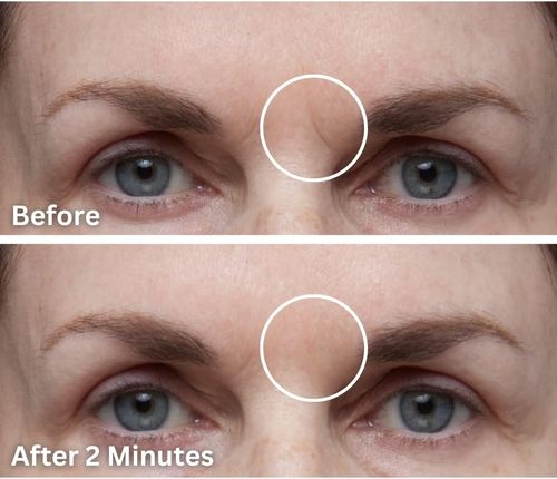 Dermaflage Topical Scar Filler Single Refill Applicator (Light) - Hollywood Sil — image 3