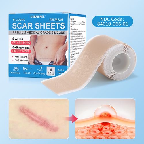150cm Silicone Scar Tape Scar Sheets Tape Roll For Sensitive Skin Face Wrinkle — image 2